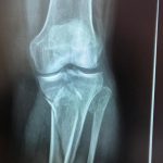 Traumatología y ortopedia - UnidadDoc